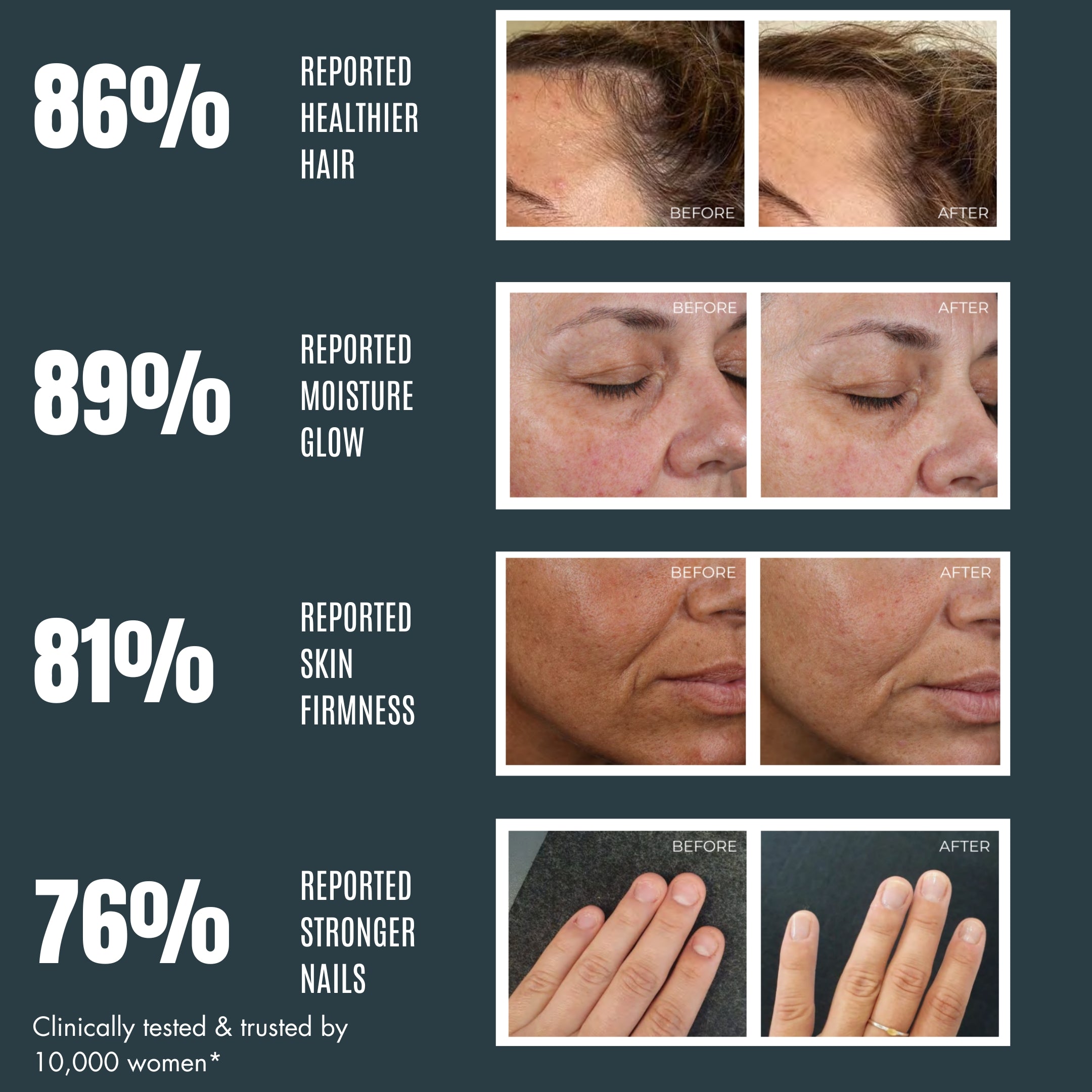 Collagen – Pure Peptides Neutral